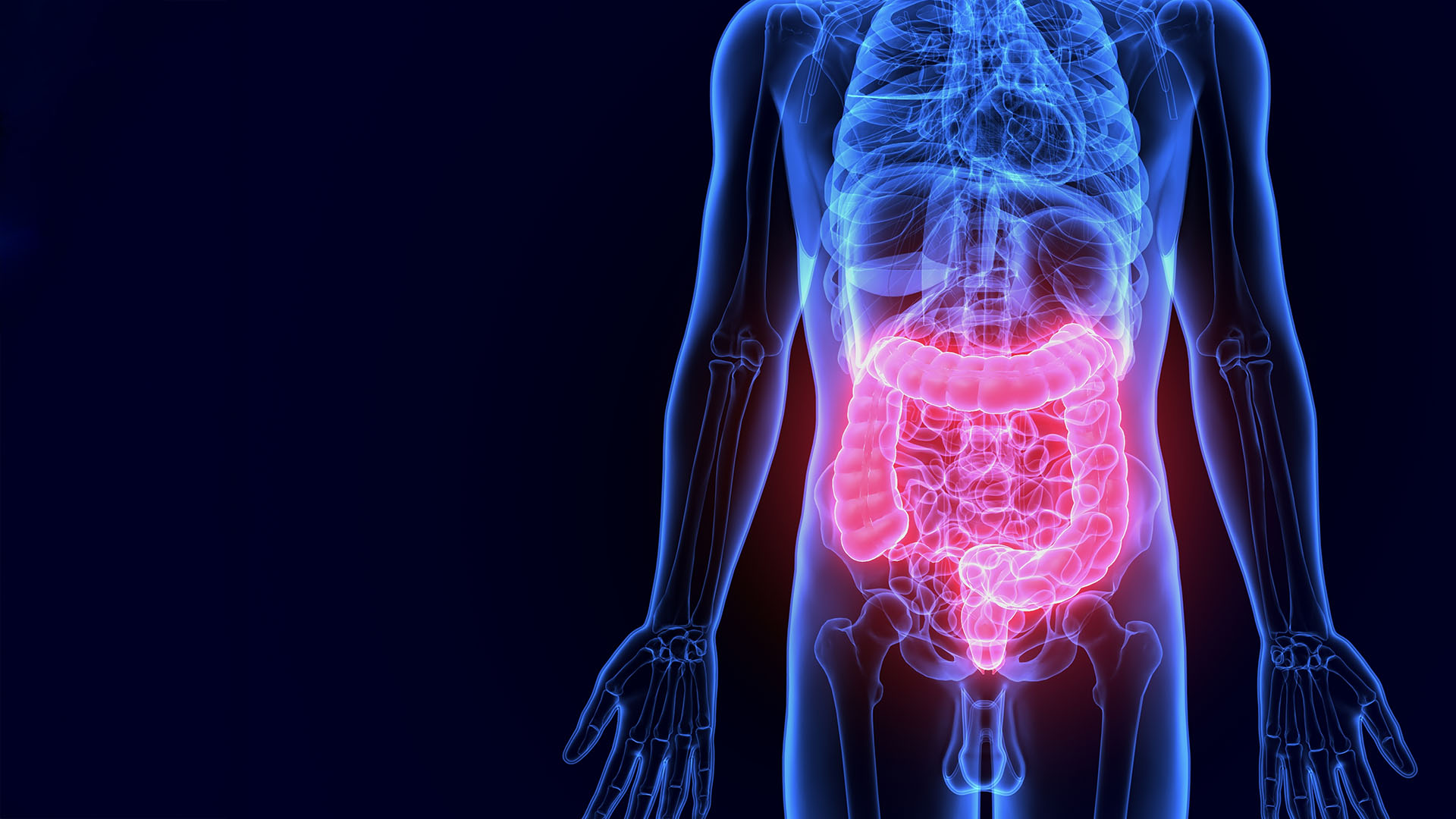 Dec 2020 - Inflammatory Bowel Disease