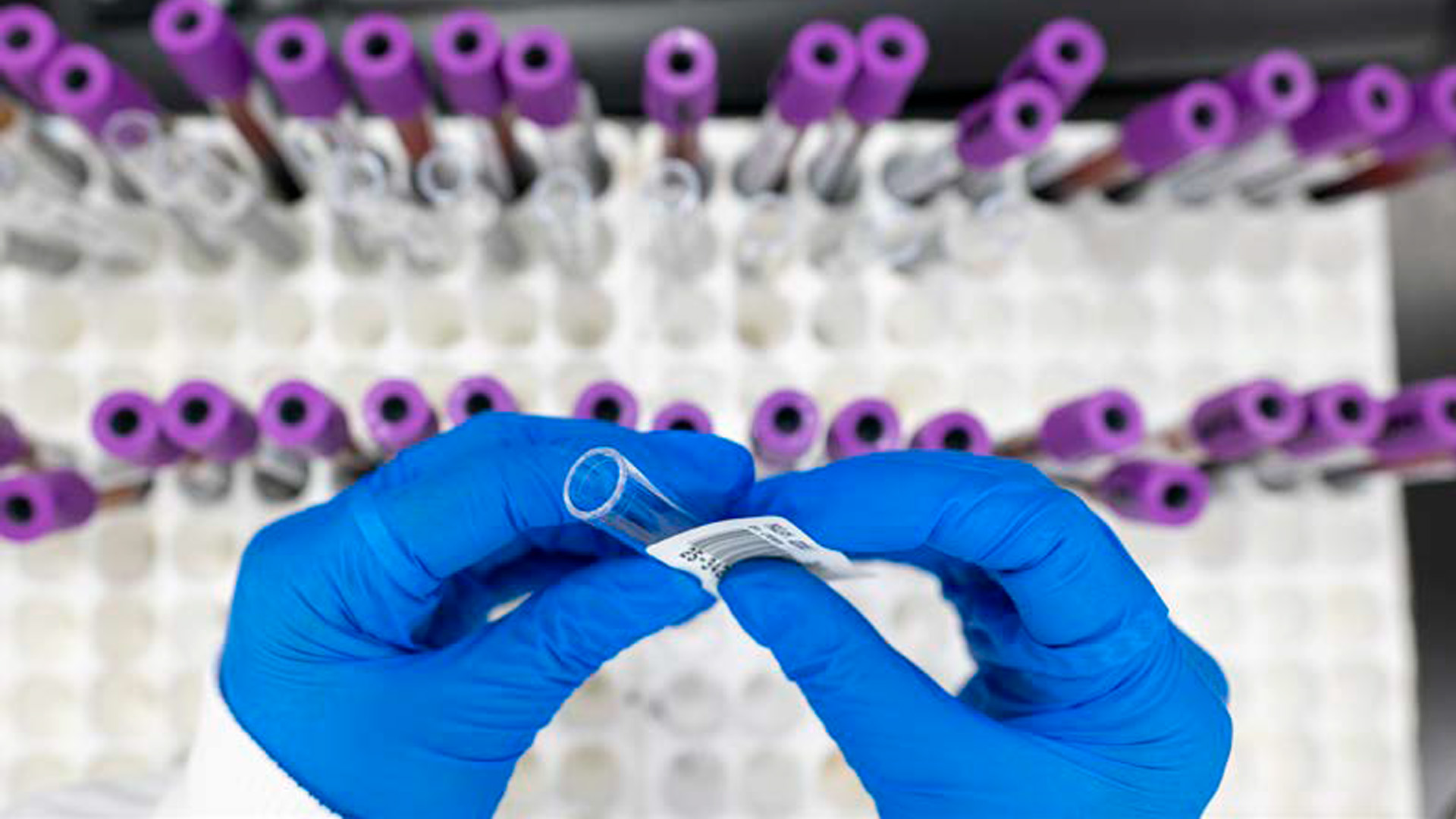 Dec 2025 - Coeliac disease