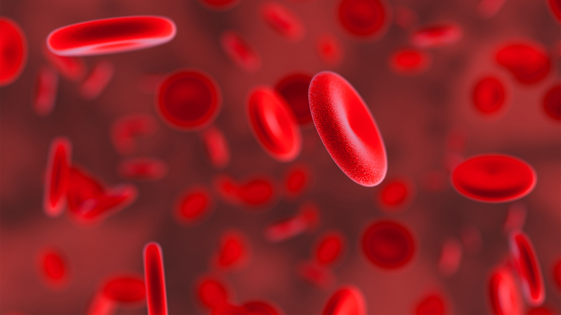 June 2023 - Iron Infusions