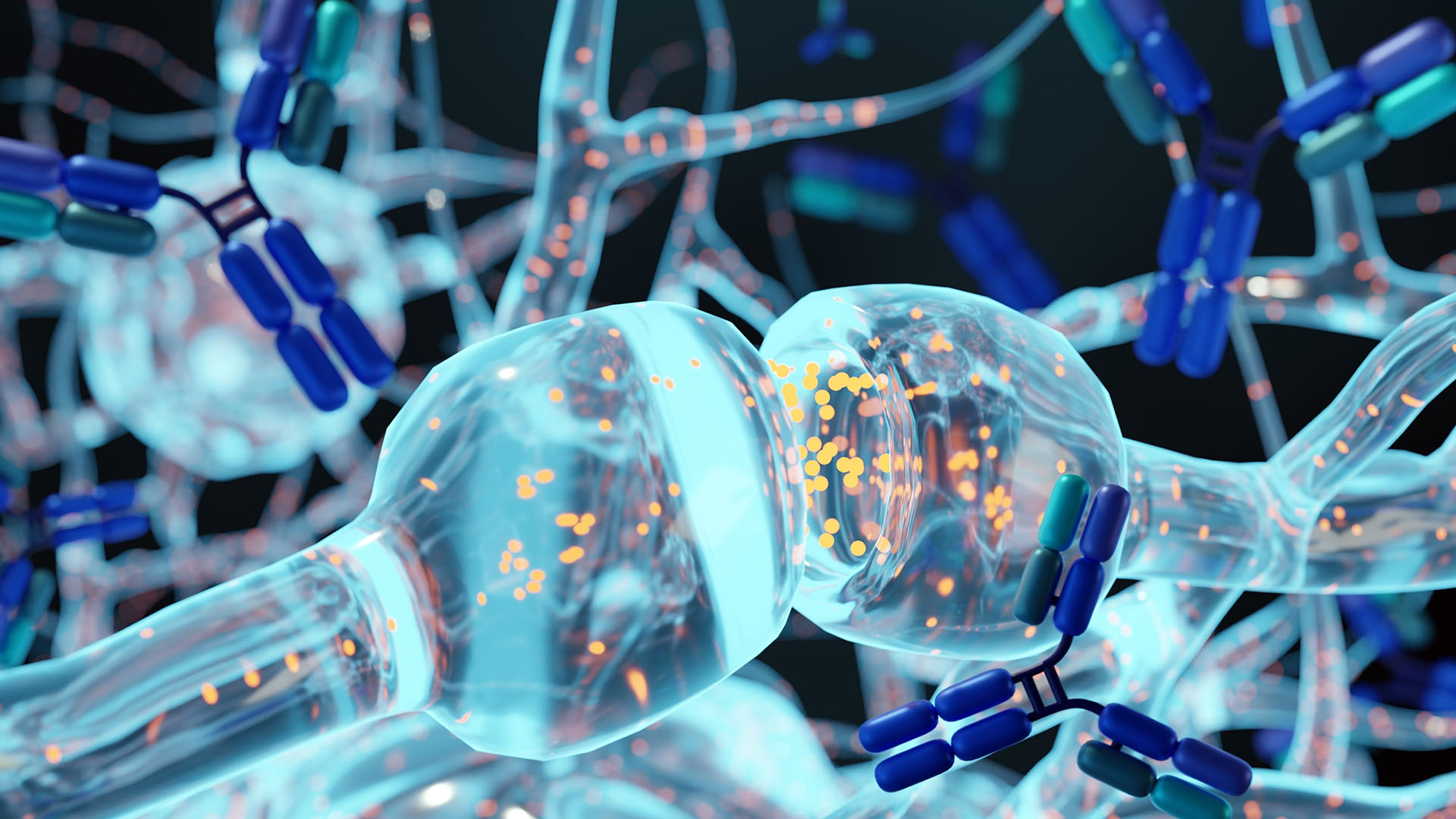 March 2025 - Diagnostic Complexities Lupus