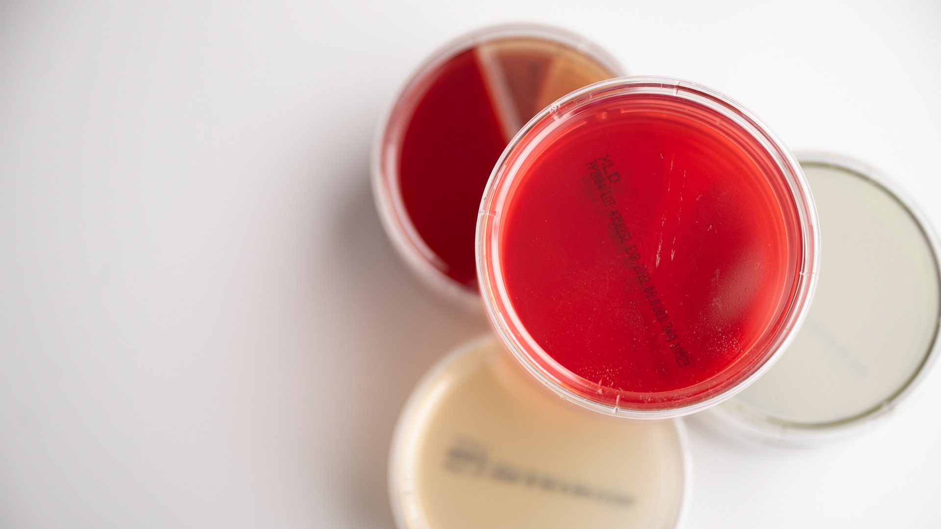 Patient Instructions - Faeces