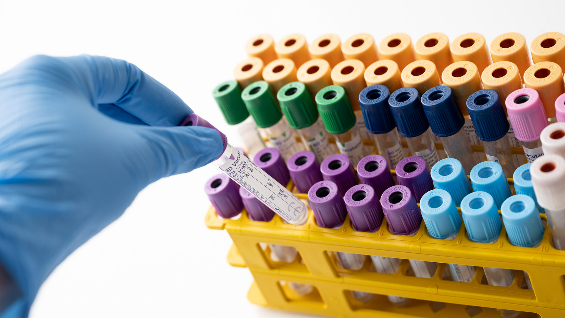 Quality Assurance banner 1