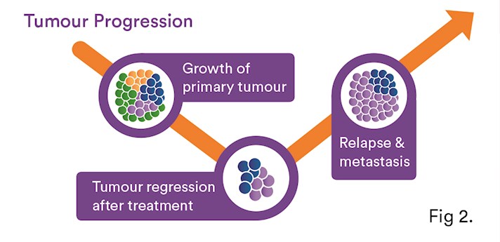 tumour-progression